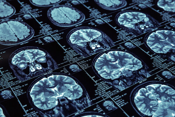 Magnetic resonance imaging